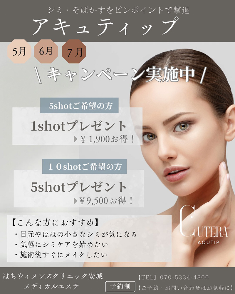 キャンセル料の設定